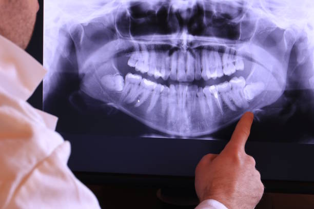 Best Emergency Gum Pain Relief  in Hillsboro, WI